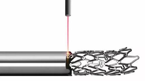 国产火鹰支架视频,创新引领心血管介入治疗新篇章